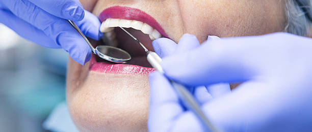 Best Emergency Root Canal Treatment in Pineland, TX